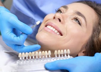 Benefits And Procedure Of Teeth Whitening