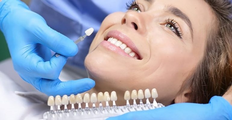 Benefits And Procedure Of Teeth Whitening