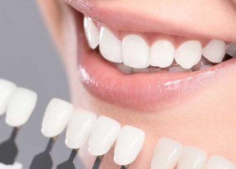 teeth-whitening-certification-classes