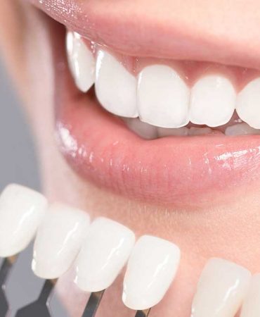 teeth-whitening-certification-classes